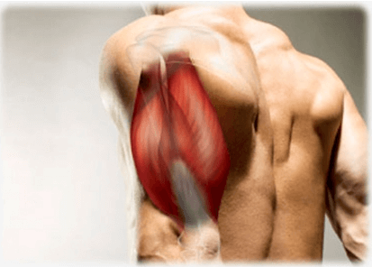 The tricep, as the name alludes, is a muscle made of three muscle heads; the long, medial and lateral head